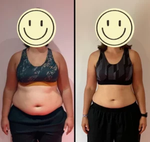 -25kg