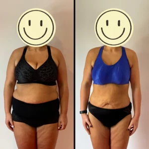 -23kg